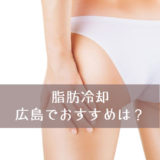 広島で安い脂肪冷却は信頼できる？おすすめのエステを紹介します